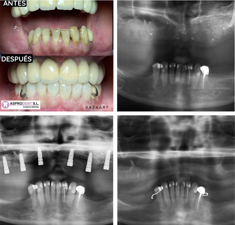 Cirugia oral en zaragoza