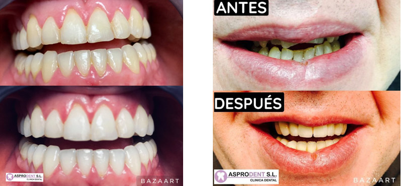 Dentista infantil en Zaragoza