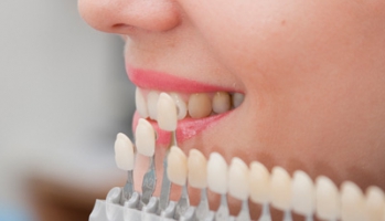 Prótesis dentales